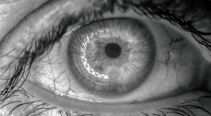 Derrame ocular podría ser señal de hipertensión o diabetes