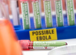 Uganda se declara libre de ébola tras 42 días sin nuevos contagios