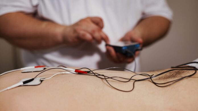 electroacupuntura