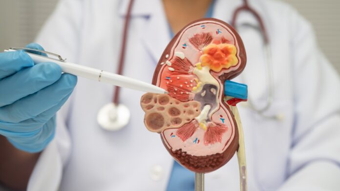 Enfermedad renal